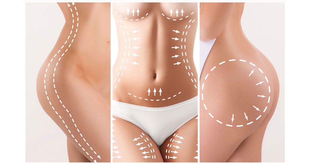 7 Most Treated Areas for Liposuction at Our Scottsdale Practice