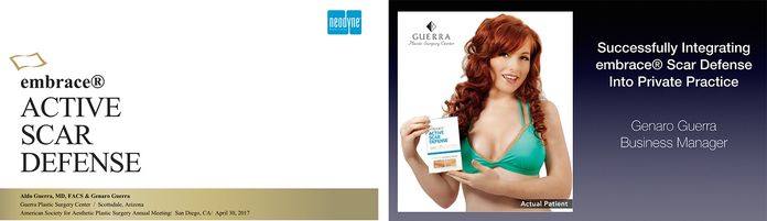 slide from embrace presentation