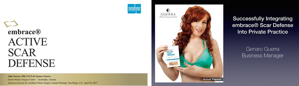 Presentation on the Clinical and Business Side of Integrating embrace® Active Scar Defense