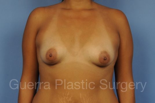 prev Case #1004005 Before