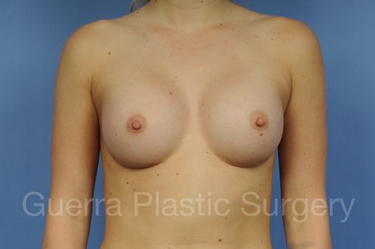 next Case #1002164 After