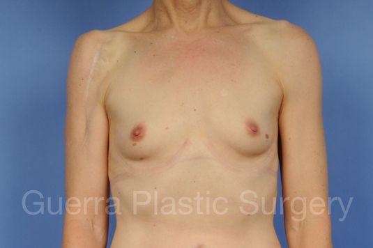 prev Case #1002161 Before