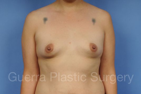 prev Case #1002160 Before