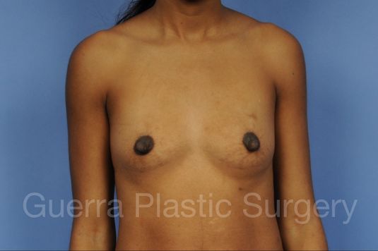 prev Case #1002158 Before