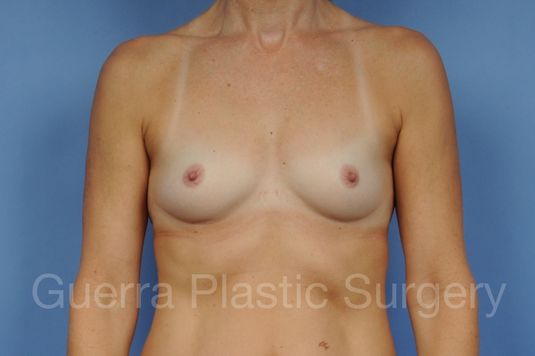 prev Case #19887 Before