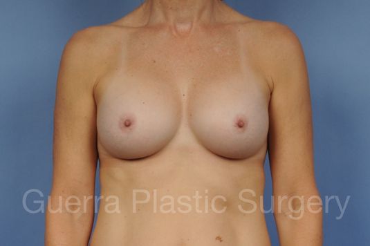 prev Case #19887 After