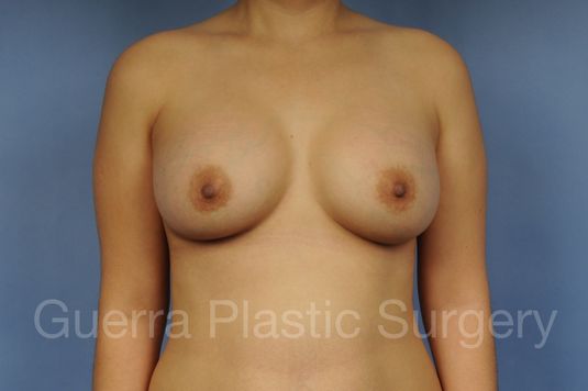 next Case #1002179 After