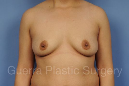 prev Case #1001177 Before