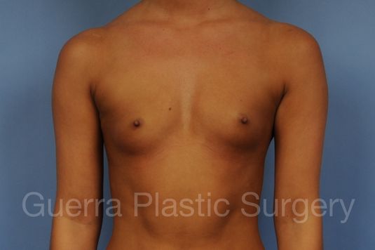 prev Case #1001182 Before