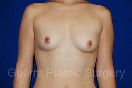 next Case #31847 Before