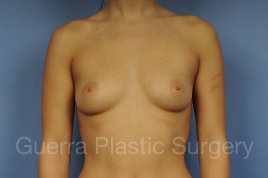 prev Case #1002170 Before