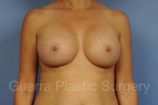 next Case #1002169 After