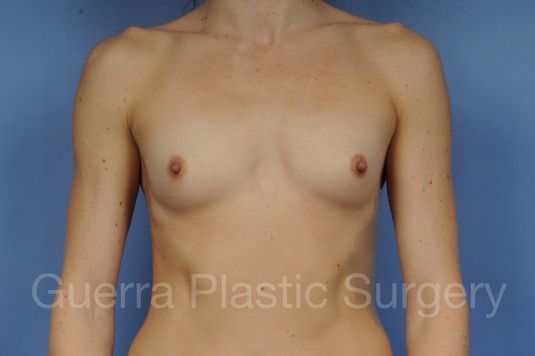 prev Case #1001183 Before