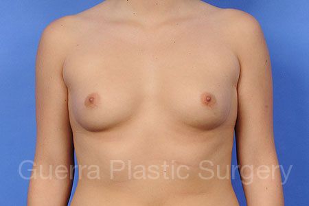 prev Case #30458 Before