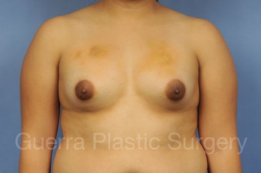 prev Case #1001186 Before