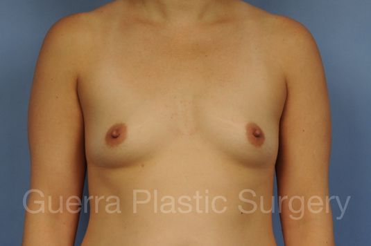 prev Case #1001187 Before