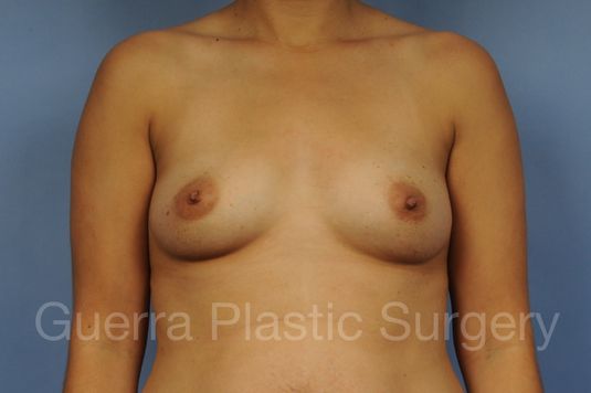 prev Case #1001190 Before