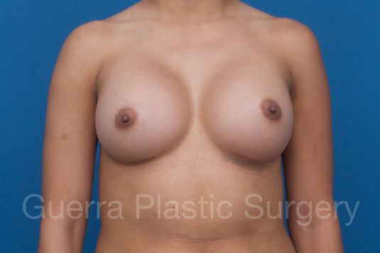 next Case #1001192 After