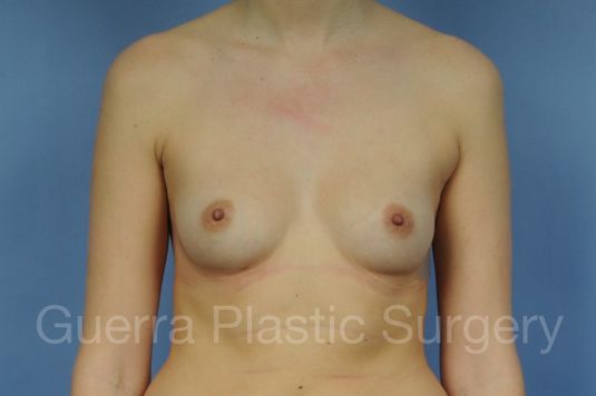 next Case #21426 Before