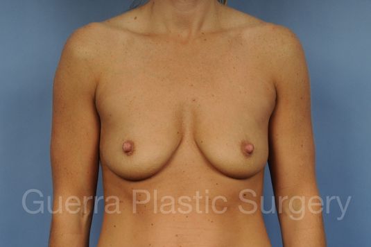 prev Case #1001198 Before