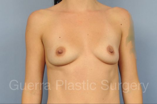 prev Case #1001199 Before