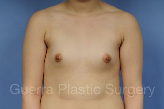 prev Case #1001203 Before