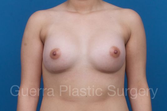 prev Case #1001203 After