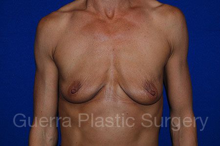 prev Case #25903 Before