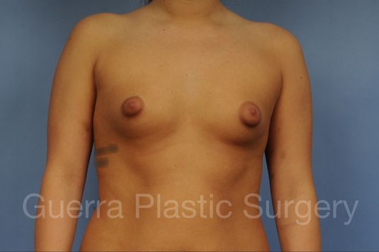 prev Case #1001204 Before