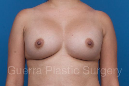 next Case #1001207 After