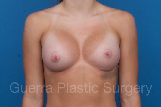 next Case #1001209 After