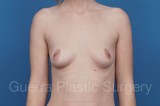 next Case #29091 Before