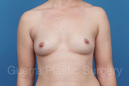 next Case #29190 Before