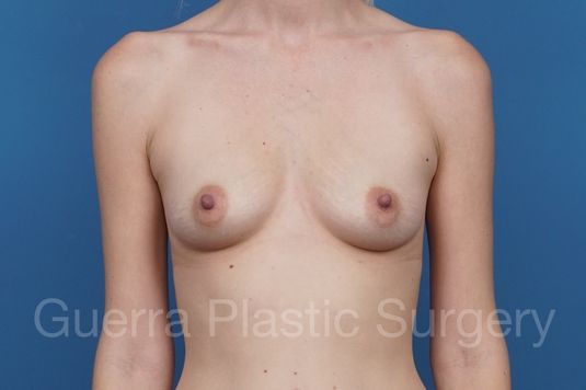 prev Case #29243 Before