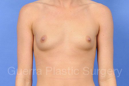 next Case #30217 Before