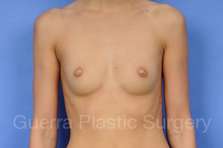 next Case #30898 Before