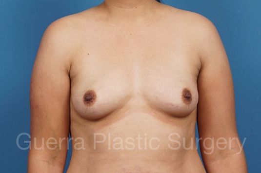 prev Case #34700 Before