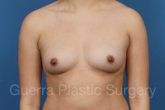 next Case #34699 Before