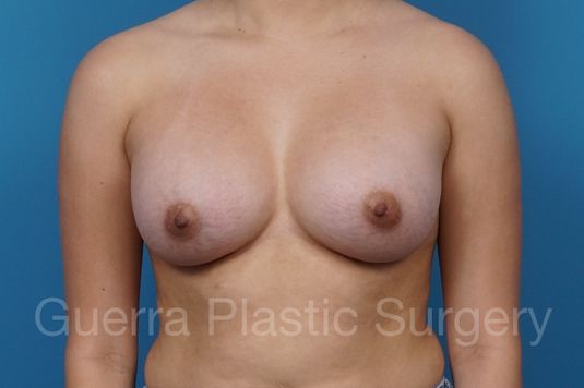 next Case #34699 After