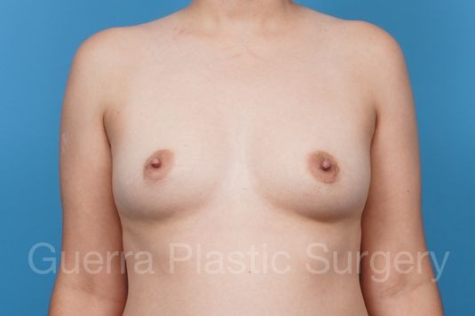 next Case #39785 Before