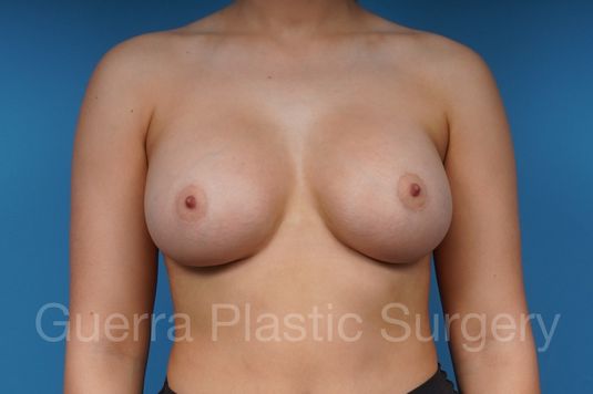 next Case #40394 After