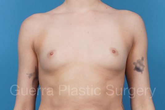 next Case #41248 Before