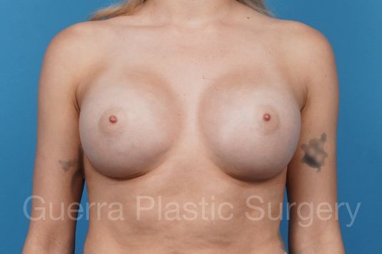 next Case #41248 After