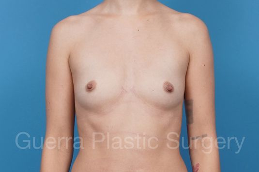 prev Case #41343 Before