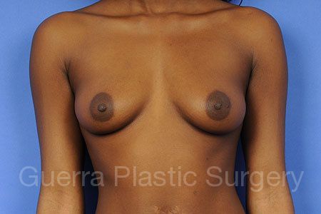 prev Case #85967 Before