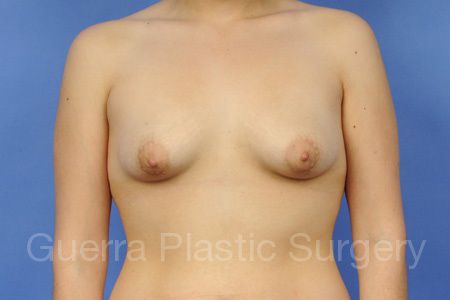 prev Case #25879 Before