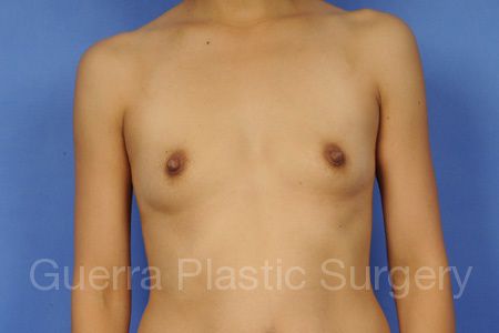 next Case #35769 Before