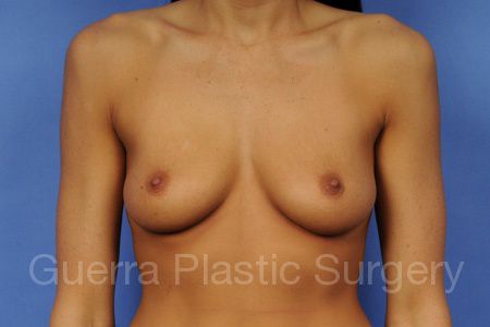 next Case #65896 Before