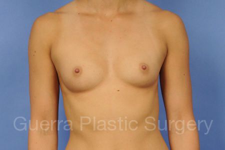 prev Case #36524 Before