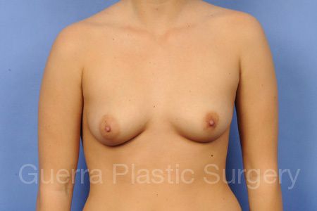 next Case #37123 Before